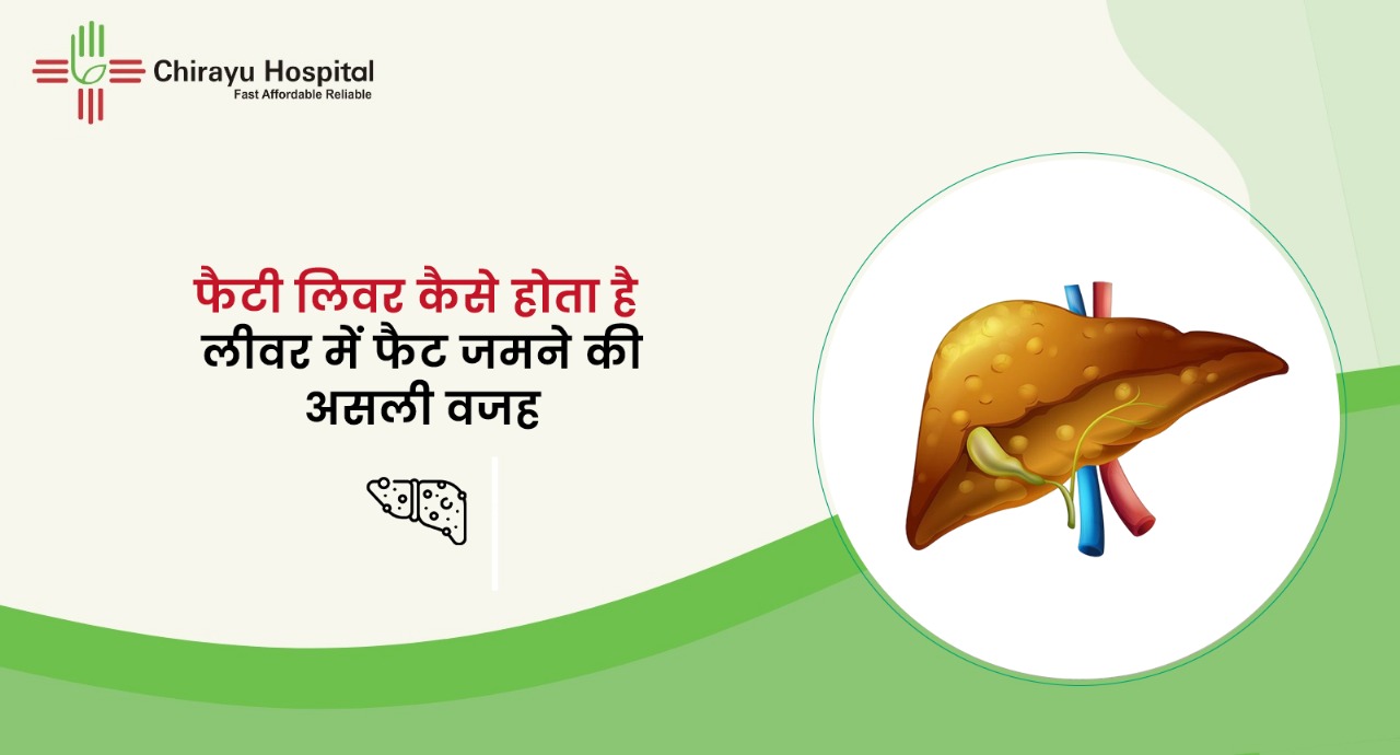 Fatty liver causes explained