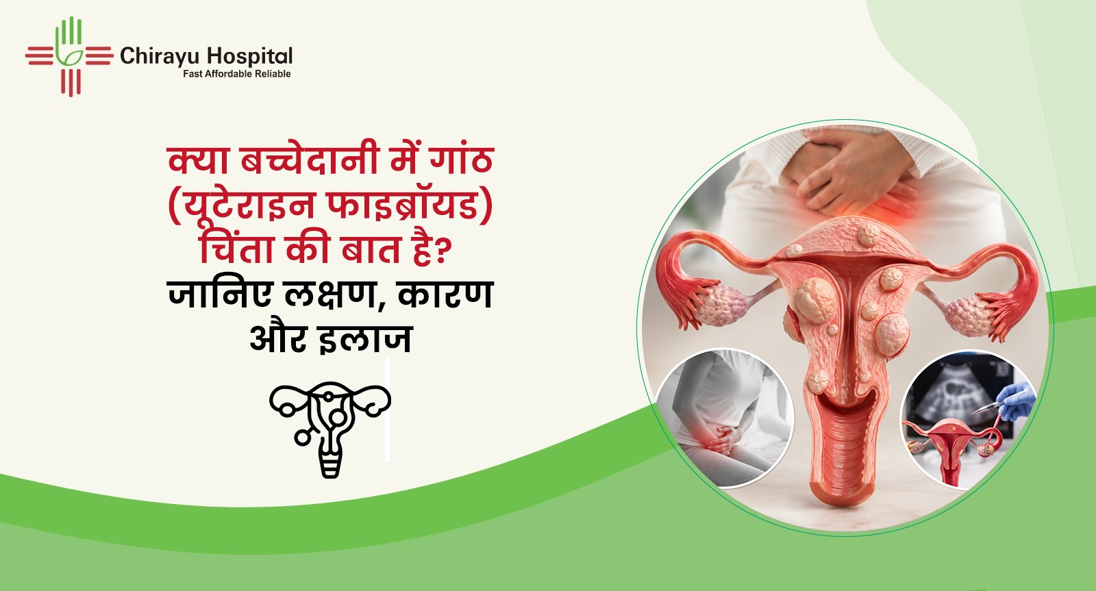 यूटेराइन फाइब्रॉयड और बच्चेदानी में गांठ के लक्षण व उपचार