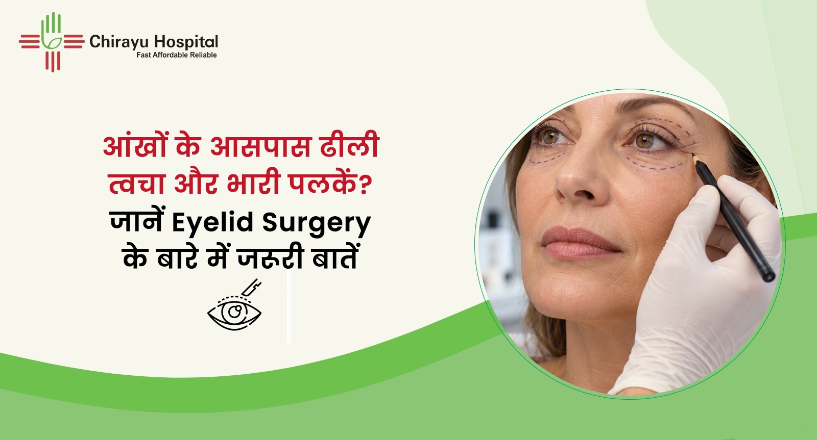 आईलिड सर्जरी से पहले आंखों के आसपास की त्वचा पर निशान बनाते विशेषज्ञ की तस्वीर और चिरायु हॉस्पिटल का ब्लॉग बैनर
